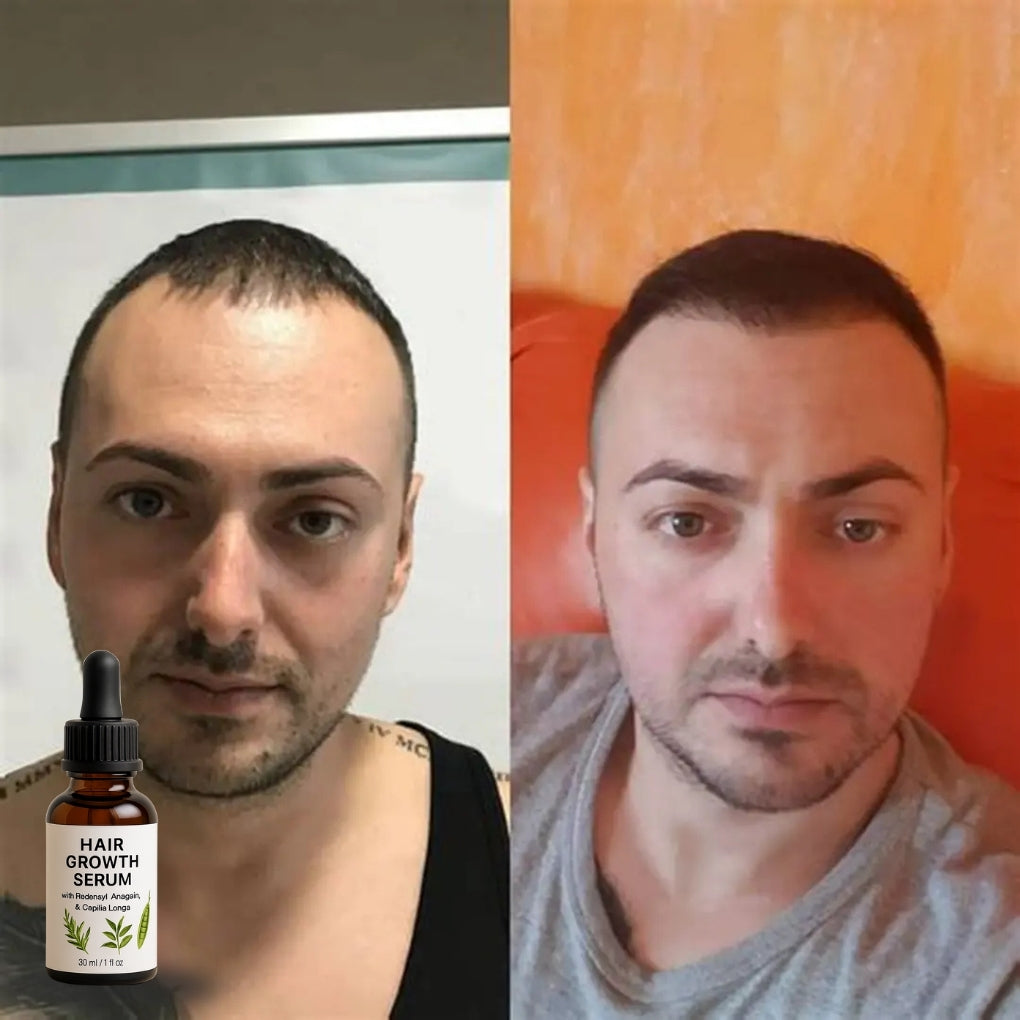 Firmelià Siero Post-Trattamento per la Ricrescita dei Capelli