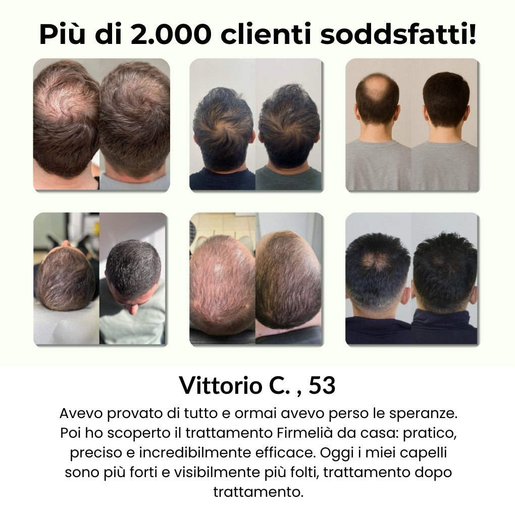 Sistema di Microinfusione Capillare Firmelià PRO®